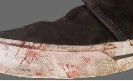 zapatilla de Thomsen