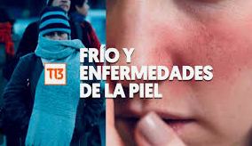 Enfermedades de la piel